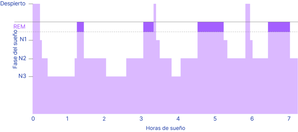 Gráfico de un ciclo normal de sueño de unas 7 horas, con alternancia entre las fases N1, N2, N3 y REM y breves despertares